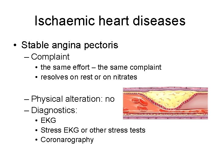 Ischaemic heart diseases • Stable angina pectoris – Complaint • the same effort – Ischaemic heart diseases • Stable angina pectoris – Complaint • the same effort –