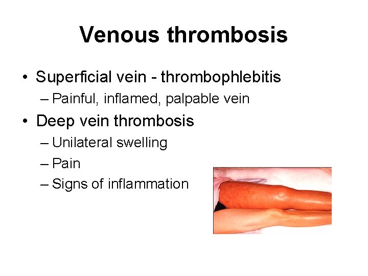 Venous thrombosis • Superficial vein - thrombophlebitis – Painful, inflamed, palpable vein • Deep Venous thrombosis • Superficial vein - thrombophlebitis – Painful, inflamed, palpable vein • Deep