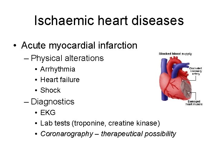 Ischaemic heart diseases • Acute myocardial infarction – Physical alterations • Arrhythmia • Heart Ischaemic heart diseases • Acute myocardial infarction – Physical alterations • Arrhythmia • Heart