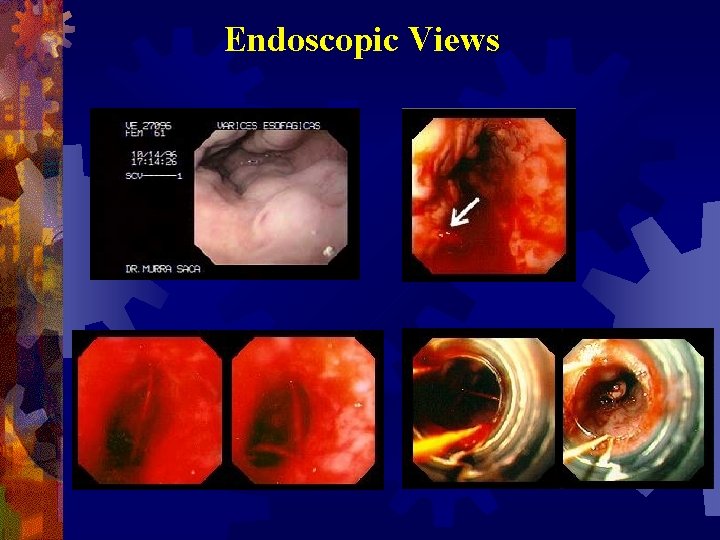 Endoscopic Views 