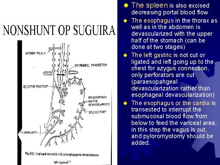 ® The spleen is also excised decreasing portal blood flow ® The esophagus in
