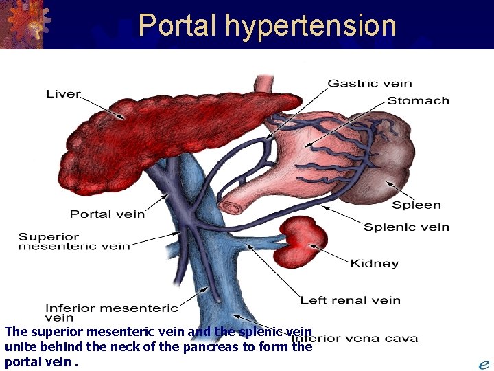 Portal hypertension The superior mesenteric vein and the splenic vein unite behind the neck