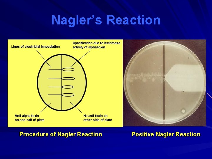Nagler’s Reaction Procedure of Nagler Reaction Positive Nagler Reaction 