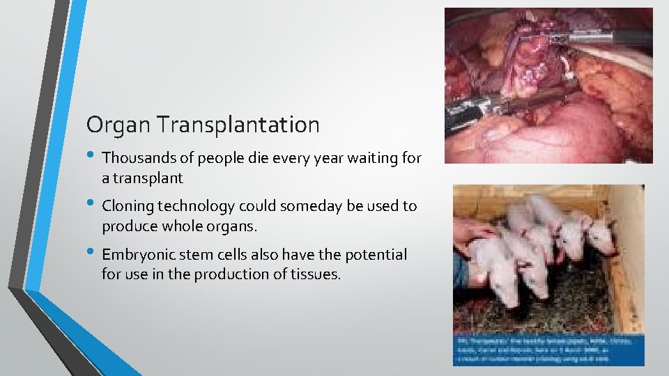 Organ Transplantation • Thousands of people die every year waiting for a transplant •