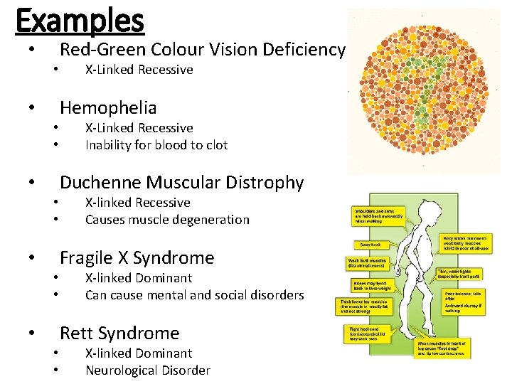 Examples Red-Green Colour Vision Deficiency • • X-Linked Recessive Hemophelia • • • X-Linked