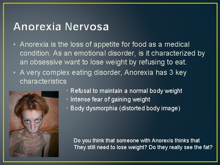 Anorexia Nervosa • Anorexia is the loss of appetite for food as a medical