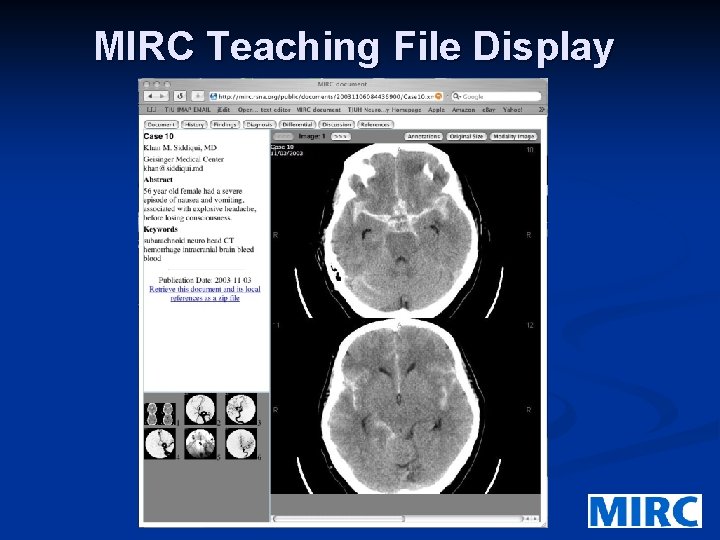 MIRC Teaching File Display 