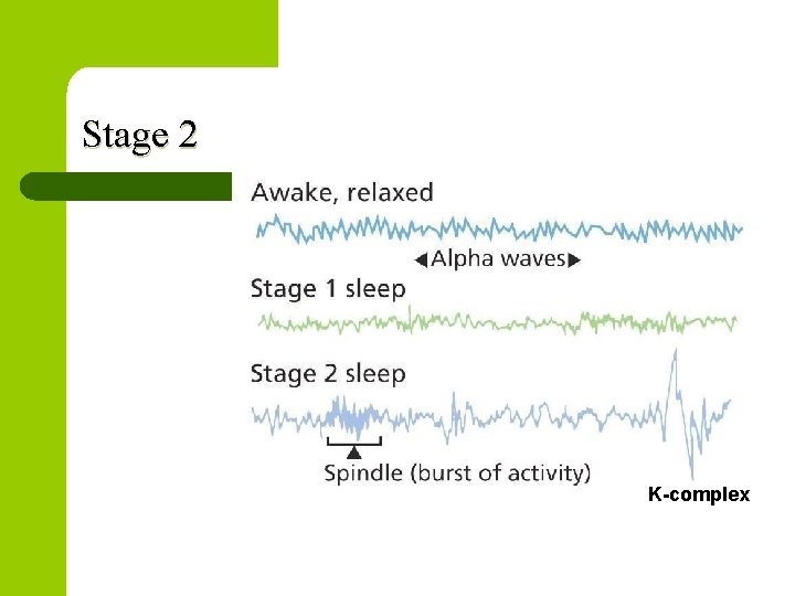 Stage 2 K-complex 