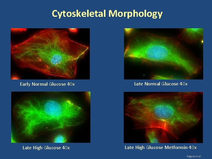 Cytoskeletal Morphology Early Normal Glucose 40 x Late High Glucose Metformin 40 x Rogers