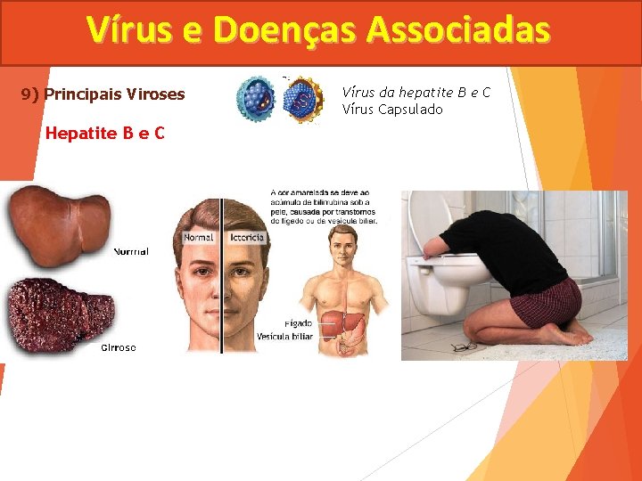 Vírus e Doenças Associadas 9) Principais Viroses Hepatite B e C Vírus da hepatite