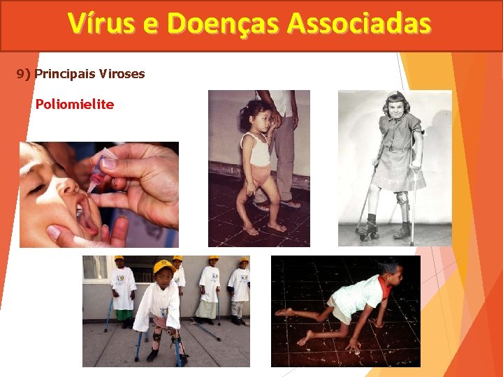 Vírus e Doenças Associadas 9) Principais Viroses Poliomielite 
