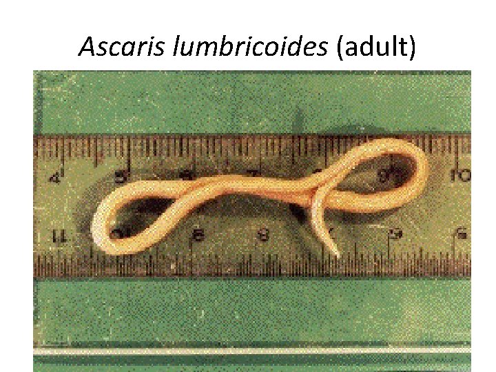 Ascaris lumbricoides (adult) 