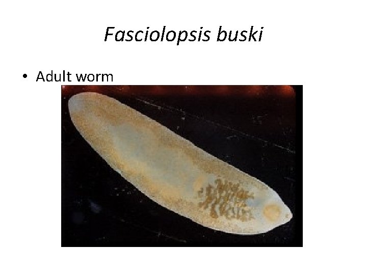 Fasciolopsis buski • Adult worm 