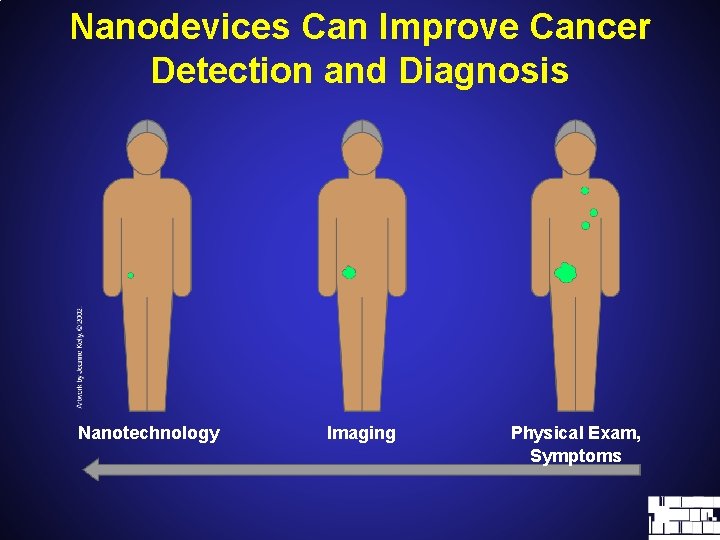 Nanodevices Can Improve Cancer Detection and Diagnosis Nanotechnology Imaging Physical Exam, Symptoms 