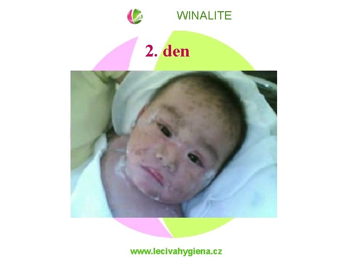 WINALITE 2. den www. lecivahygiena. cz 