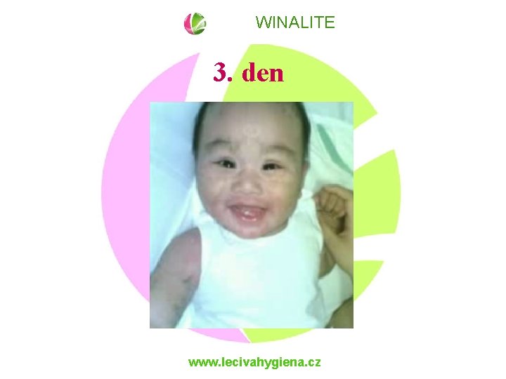 WINALITE 3. den www. lecivahygiena. cz 