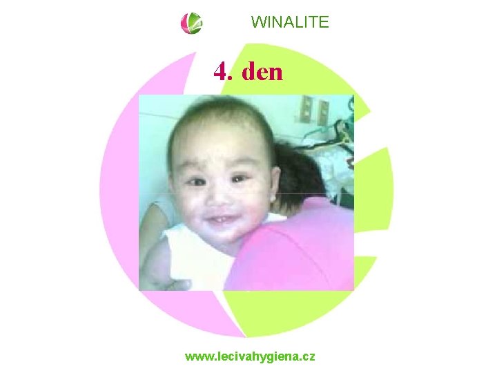 WINALITE 4. den www. lecivahygiena. cz 