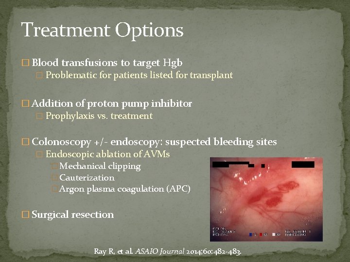 Treatment Options � Blood transfusions to target Hgb � Problematic for patients listed for