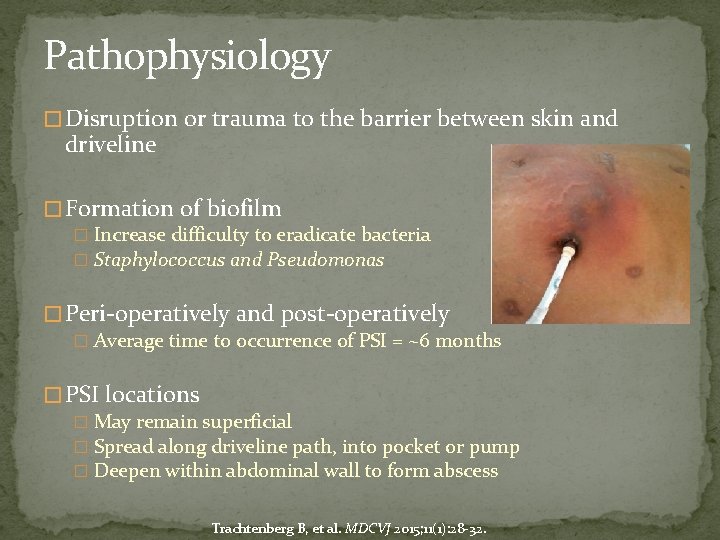Pathophysiology � Disruption or trauma to the barrier between skin and driveline � Formation