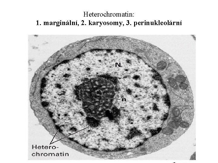 Heterochromatin: 1. marginální, 2. karyosomy, 3. perinukleolární 