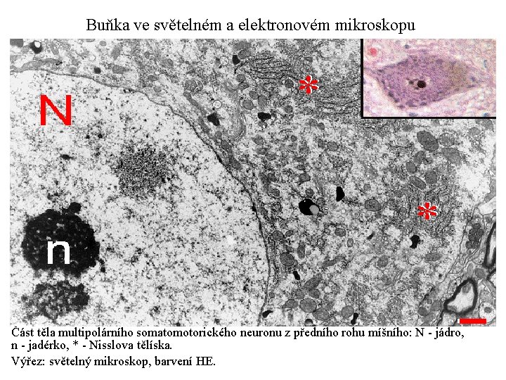 Buňka ve světelném a elektronovém mikroskopu Část těla multipolárního somatomotorického neuronu z předního rohu