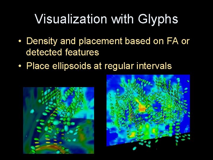 Visualization with Glyphs • Density and placement based on FA or detected features •