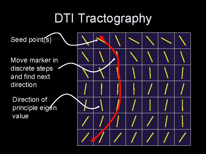 DTI Tractography Seed point(s) Move marker in discrete steps and find next direction Direction