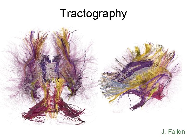 Tractography J. Fallon 