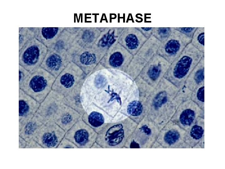 METAPHASE 