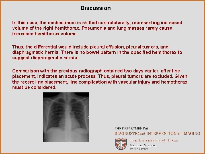 Discussion In this case, the mediastinum is shifted contralaterally, representing increased volume of the