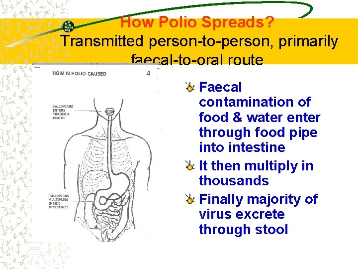 How Polio Spreads? Transmitted person-to-person, primarily faecal-to-oral route Faecal contamination of food & water