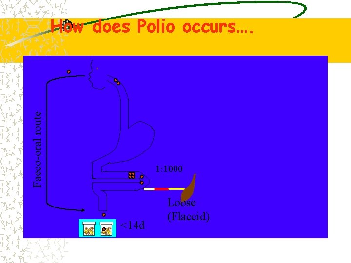 Faeco-oral route How does Polio occurs…. 1: 1000 <14 d Loose (Flaccid) 