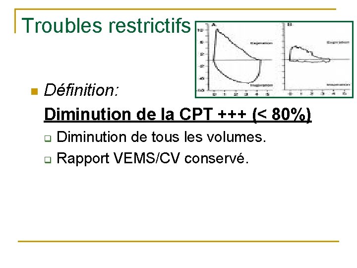 Troubles restrictifs n Définition: Diminution de la CPT +++ (< 80%) q q Diminution