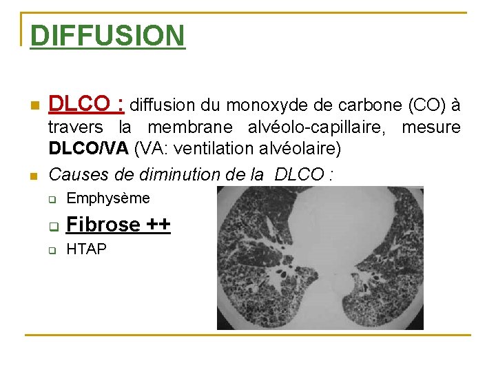 DIFFUSION n DLCO : diffusion du monoxyde de carbone (CO) à n travers la