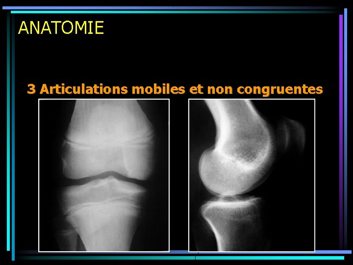 ANATOMIE 3 Articulations mobiles et non congruentes 