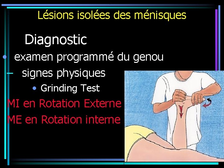 Lésions isolées des ménisques Diagnostic • examen programmé du genou – signes physiques •