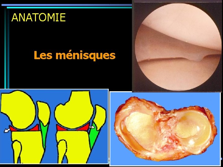 ANATOMIE Les ménisques 