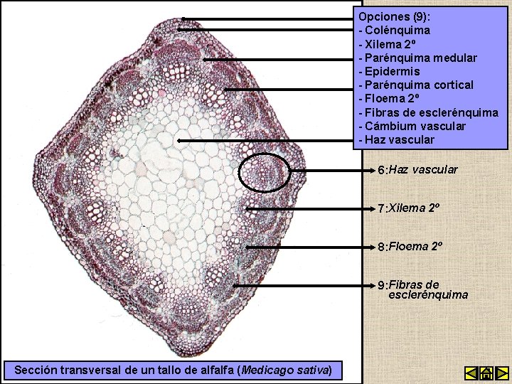 Opciones (9): 1: Epidermis - Colénquima 2: Colénquima - Xilema 2º - Parénquima medular