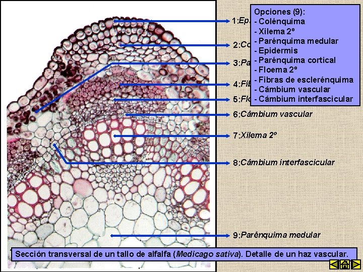 Opciones (9): 1: Epidermis - Colénquima - Xilema 2º - Parénquima medular 2: Colénquima