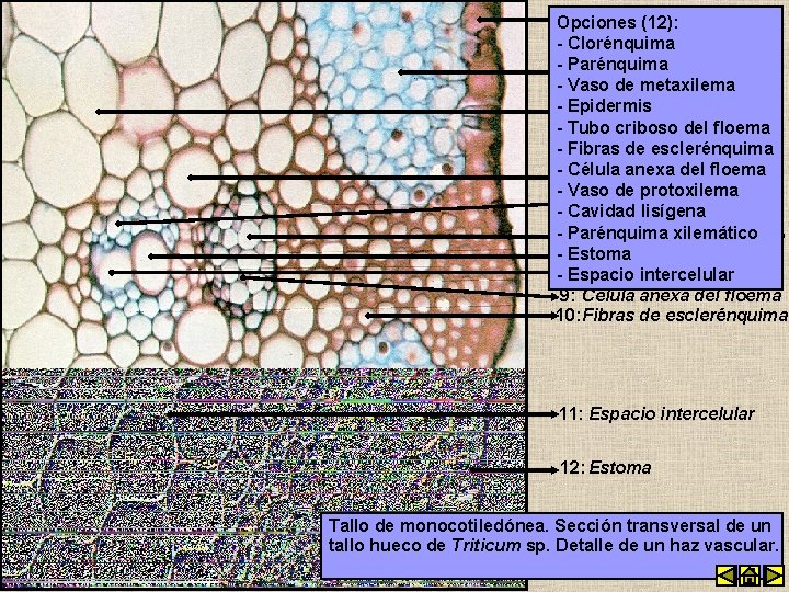 1: Epidermis Opciones (12): - Clorénquima -2: Parénquima Clorénquima - Vaso de metaxilema -3: