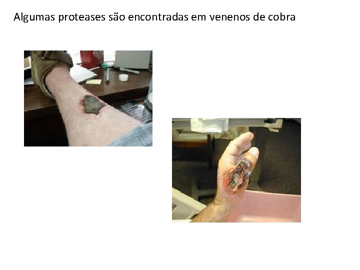 Algumas proteases são encontradas em venenos de cobra Algumas proteases são encontradas em venenos de cobra
