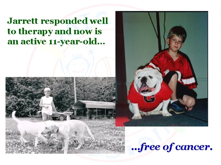 Jarrett responded well to therapy and now is an active 11 -year-old… …free of