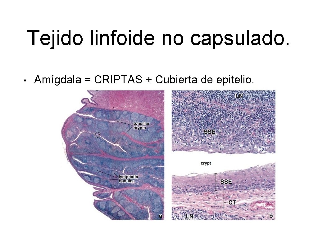 Tejido linfoide no capsulado. • Amígdala = CRIPTAS + Cubierta de epitelio. 