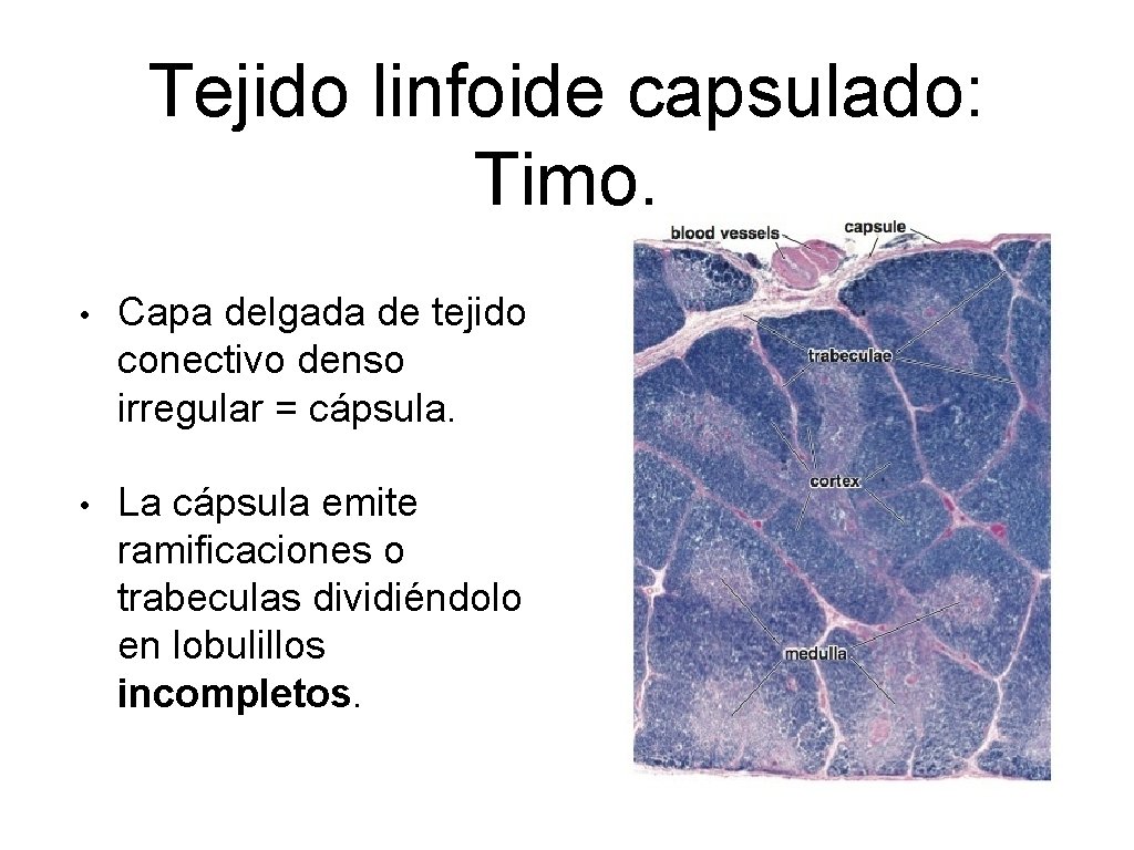 Tejido linfoide capsulado: Timo. • Capa delgada de tejido conectivo denso irregular = cápsula.
