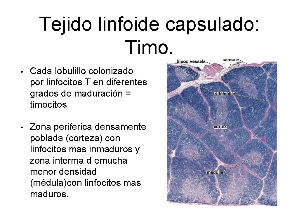 Tejido linfoide capsulado: Timo. • Cada lobulillo colonizado por linfocitos T en diferentes grados