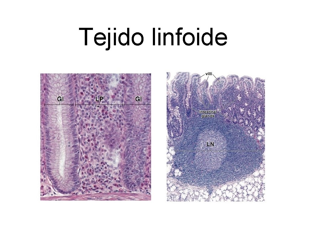 Tejido linfoide 