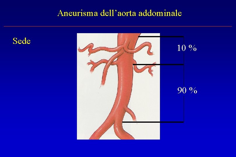 Aneurisma dell’aorta addominale Sede 10 % 90 % 