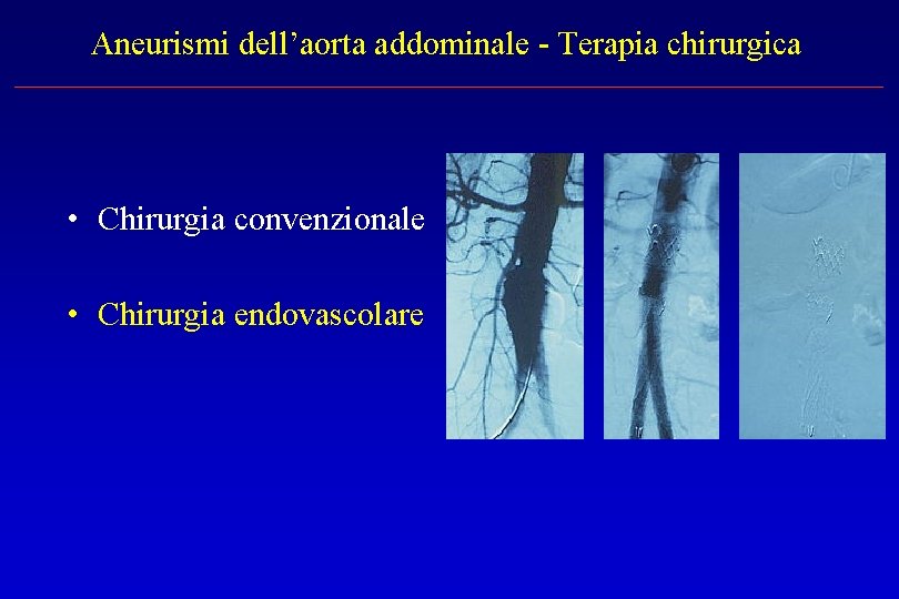 Aneurismi dell’aorta addominale - Terapia chirurgica • Chirurgia convenzionale • Chirurgia endovascolare 