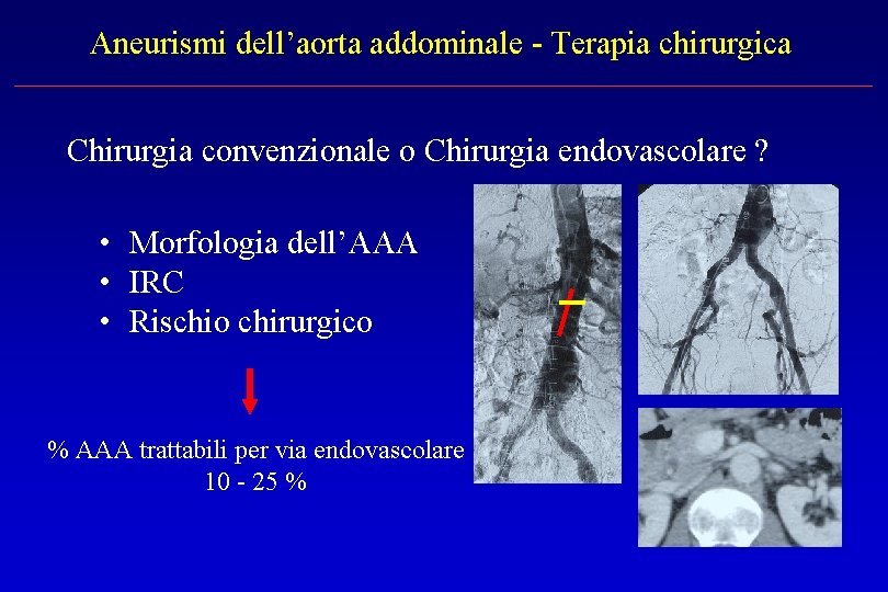 Aneurismi dell’aorta addominale - Terapia chirurgica Chirurgia convenzionale o Chirurgia endovascolare ? • Morfologia