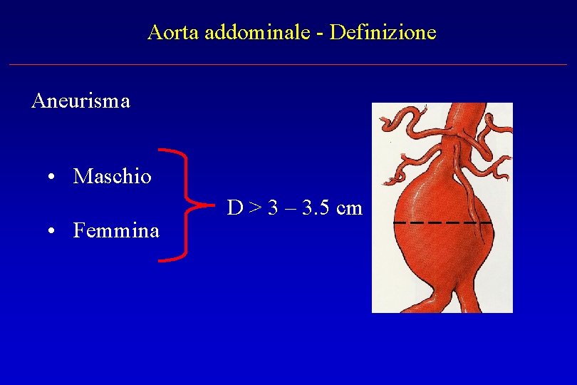 Aorta addominale - Definizione Aneurisma • Maschio • Femmina D > 3 – 3.